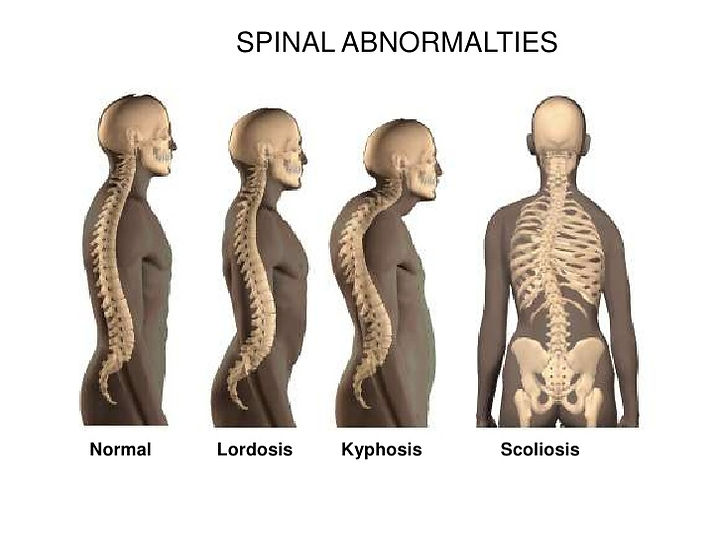 posture and ROM with lorraine mitchell fitness