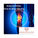 Knee Arthritis: How to Keep Moving