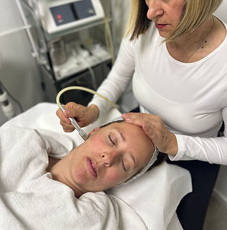 Dijamantna mikrodermoabrazija