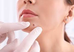 Beauty Spot Creation.jpg