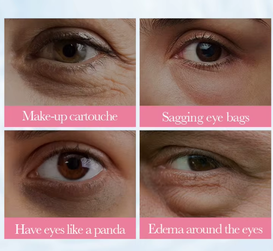 Thumbnail: מסכה קוריאנית | טיפוח עיניים | מסכות הזנה | SADOER | מסכה לעיניים