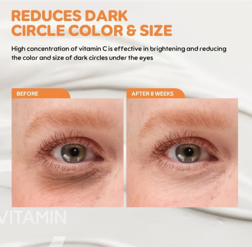 Thumbnail: DEROL | קרם עיניים ויטמין C | קרם עיניים אנטי אייג'ינג