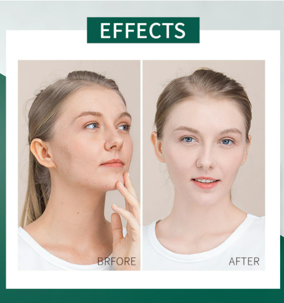 Thumbnail: מארז 20 מסכות שינה Centella: שיקום והרגעת העור בלילה