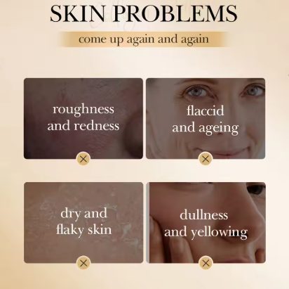 תמונה ממוזערת: מסכת שינה | מסכת קולגן | מסכת אנטי אייג'ינג | מסכה קוריאנית