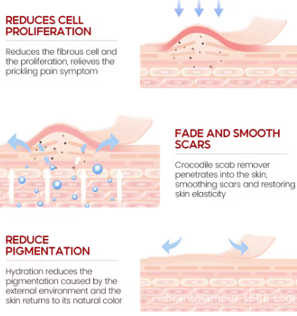 Thumbnail: קרם שיקום Vibrant Glamour: לטיפול באקנה וטשטוש צלקות