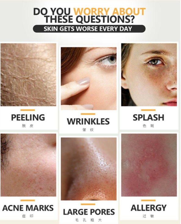 תמונה ממוזערת: LAIKOU Snail Essence: שיקום עמוק ומראה עור צעיר וחיוני