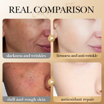 תמונה ממוזערת: מסכת שינה | מסכת קולגן | מסכת אנטי אייג'ינג | מסכה קוריאנית