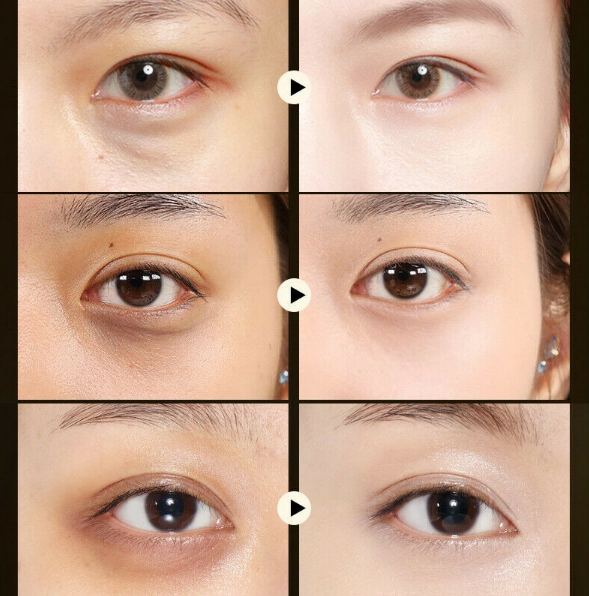 Thumbnail: IMAGES | קנו רטיות קולגן לעיניים 60 יח'  וקבלו קרם עיניים מתנה | גילמור ביוטי