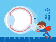 近視管理大關鍵－眼軸追蹤 遠離高度近視