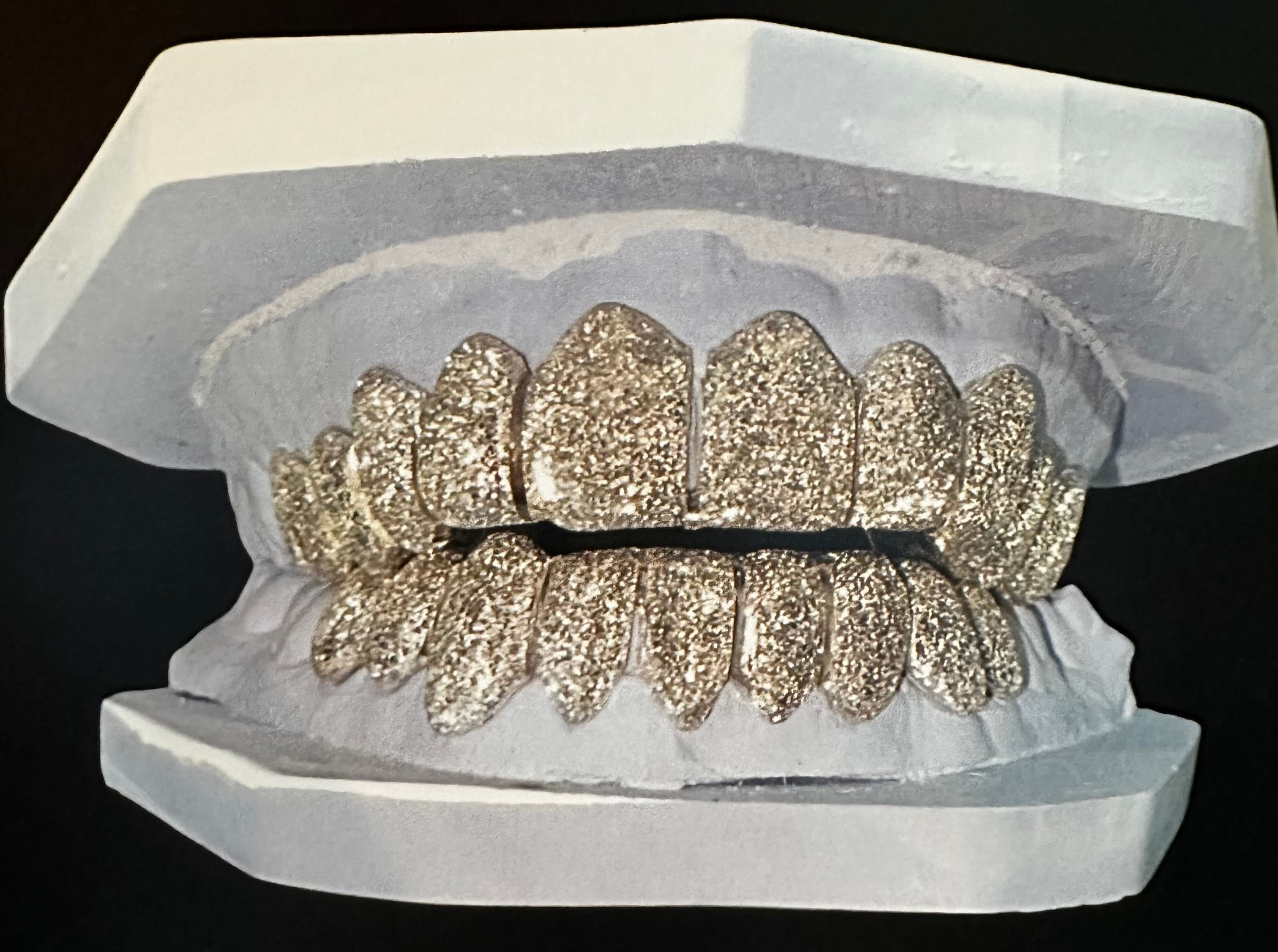 Diamond Dust Grillz