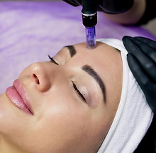 beautician-makes-injections-into-forehead-mesotherapy-with-microneedle-method-2.jpg
