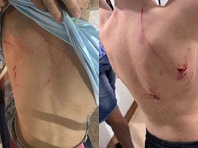 Cachorro da raça rottweiler é capturado após atacar crianças em praça