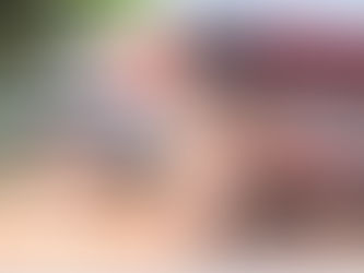 Imprudência e falta de atenção provocam acidente grave em Tangará; motociclista é socorrido com suspeita de fratura na coluna