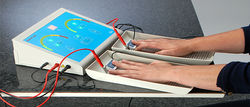 Iontophoresis