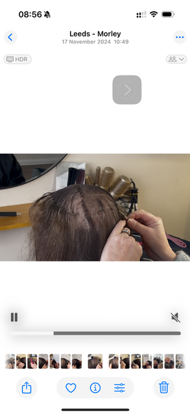 Mesh integration technique being applied to thinning hair for non surgical hair replacement