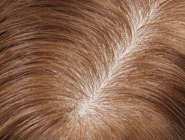 Thumbnail: Tammy Silk and mono hair topper