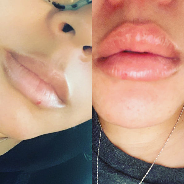 A76E9E4A-5696-459D-B80B-64AC5DC1D990.jpe