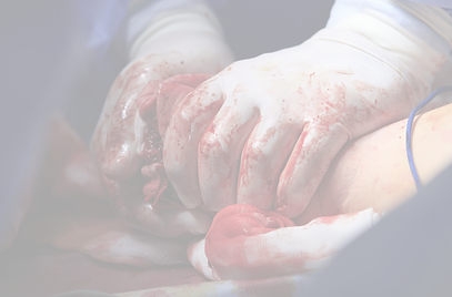 Controlling a serious bleeding injury