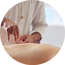 acupuncture.png