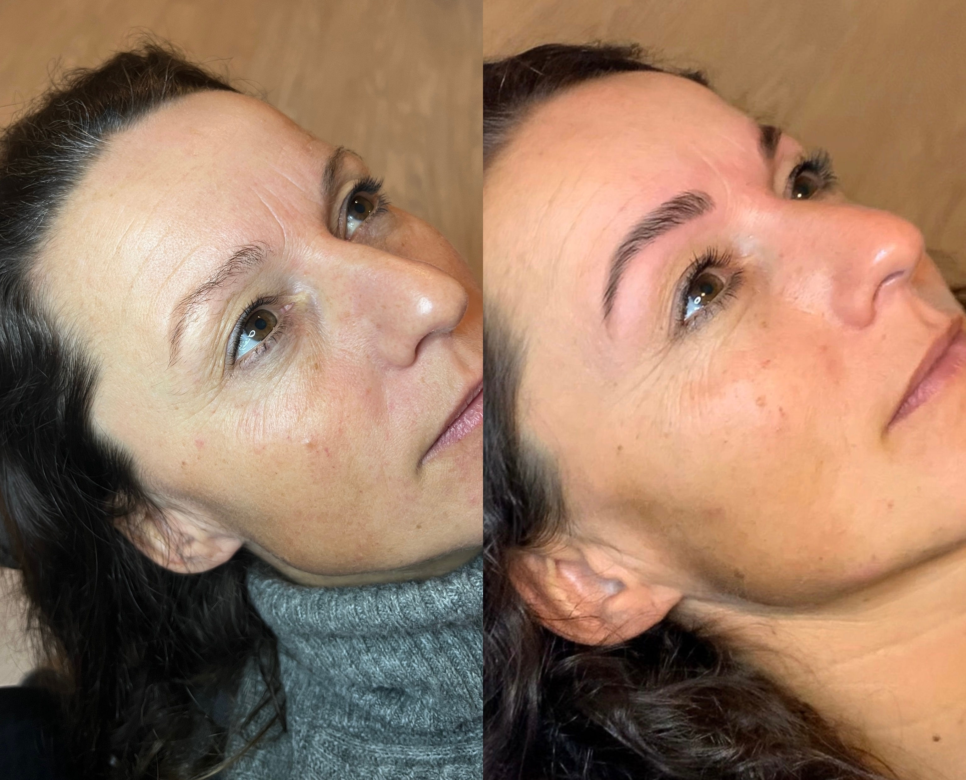 Auffrischung (ab 12 Monaten)