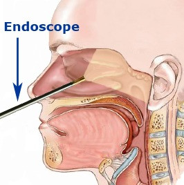 nasal endoscopy singapore