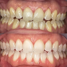 Dental Treatments in Burgess Hill