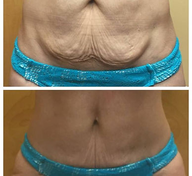 22815257_932474076900143_460712418495339