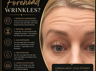 What Causes Forehead Wrinkles?