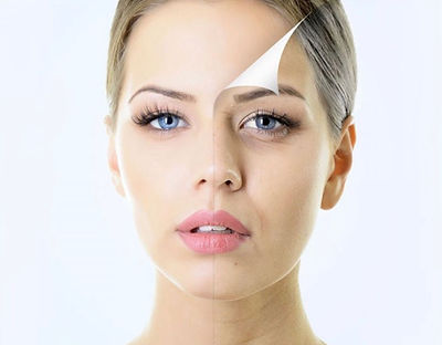 face peel.jpg