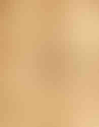 Cross section", John Arderne, De arte phisicali et de cirurgia, England ca. 1425