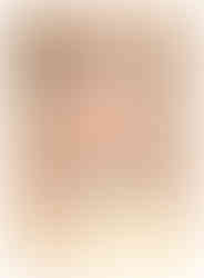 Cross section", John Arderne, De arte phisicali et de cirurgia, England ca. 1425