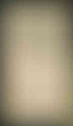 Cross section", John Arderne, De arte phisicali et de cirurgia, England ca. 1425