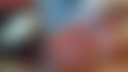 दो बच्चों के मोतियाबिंद की सर्जरी निःशुल्क हुई।