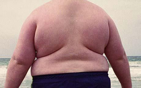 Obesidade e cirurgia de obesidade