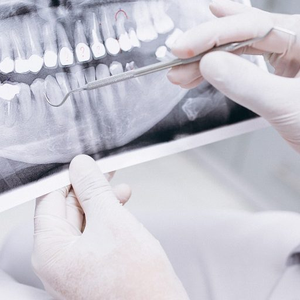 CIRUGÍA ORAL Y MAXILOFACIAL