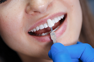 Cuando tu sonrisa necesita una transformación profunda, la experiencia especializada marca la diferencia. Desde diseño digital de sonrisa y carillas de porcelana hasta rehabilitación oral, endodoncia y cirugía, cada tratamiento, construido exactamente para ti.