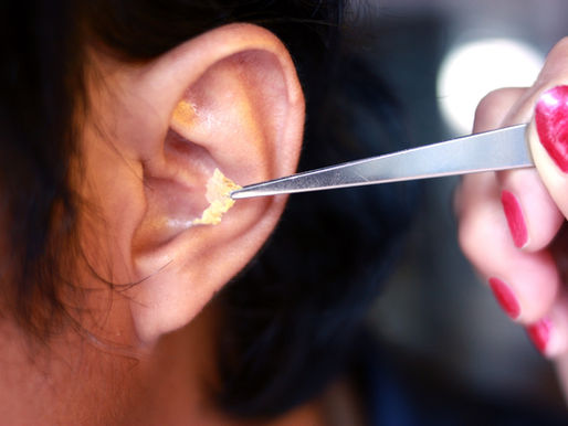Ear Wax Removal