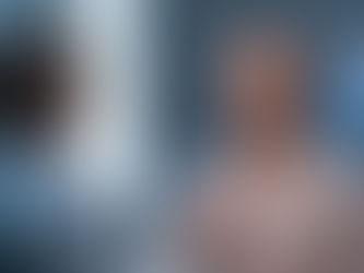 Blefaroplastia e lifting de supercílios combinados: rejuvenescimento global do olhar com resultado natural