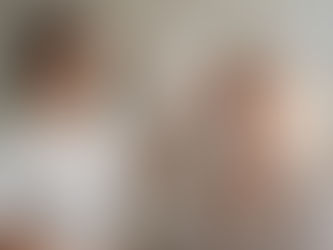 Botox deixa o rosto artificial? A verdade sobre naturalidade, técnica e dose certa