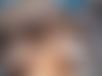 Blefaroplastia: por que a precisão técnica é decisiva para os resultados