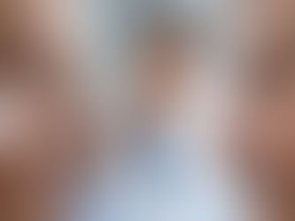 Entrópio e Ectrópio: causas, sintomas e soluções estéticas e funcionais