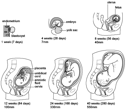 Abortion clinic in, Abortion clinic, 
