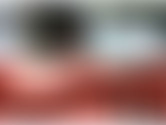 Ebola - Surto na República Democrática do Congo - África