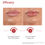 Thumbnail: Lip balm efficacy: Before & After, visibly brighter and healed lips, 78% users agreed