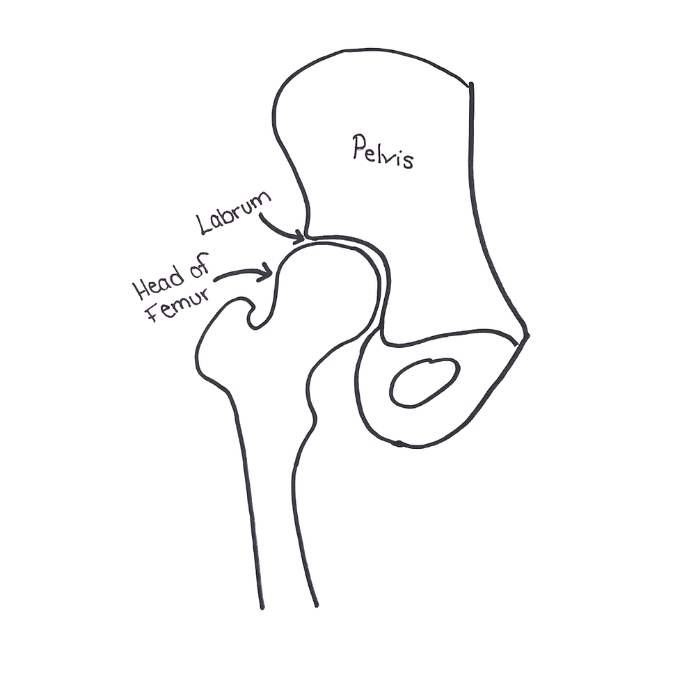 Treating Hip Impingement And Labral Tears Without Surgery: What Actually Works When Nothing Else Has