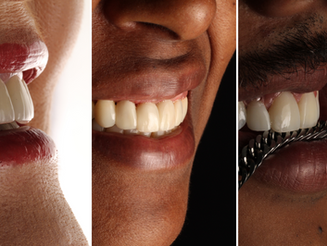 Como a estética dental pode melhorar sua autoestima e qualidade de vida
