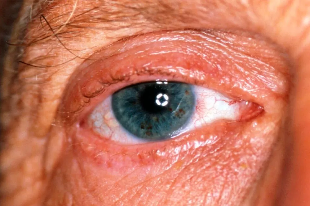 EYE CENTER Insight Complete Eye