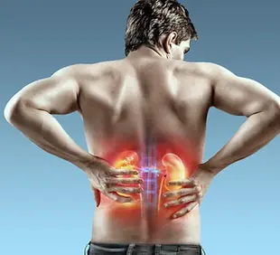 calculo-renal-imagem-1200x900.webp