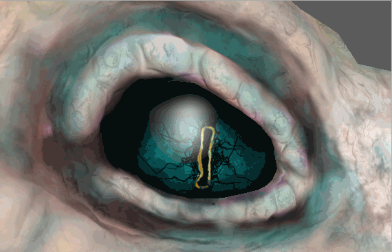 eyelid control