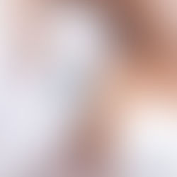 Everything You Need to Know Before Your First Laser Treatment - Laser Hair Removal